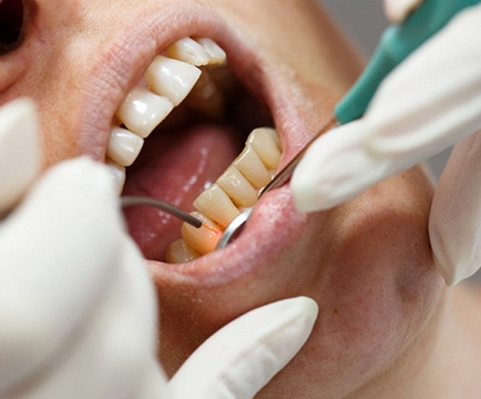 Dentist performing laser dentistry