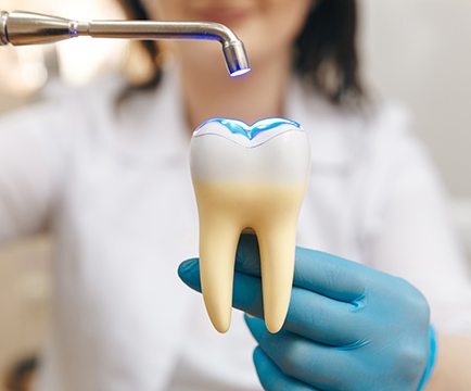 Dentist demonstrating tooth-colored filling process on large model tooth