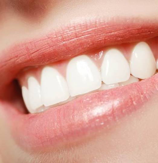 Close-up of woman’s beautiful smile after gum grafting in Baltimore