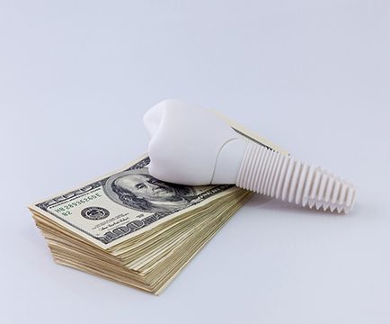 Money and model implant representing the cost of dental implants in Baltimore