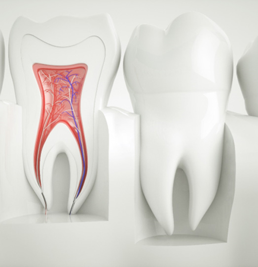 an X-ray of a molar in Baltimore