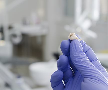 Hand holding up an extracted tooth