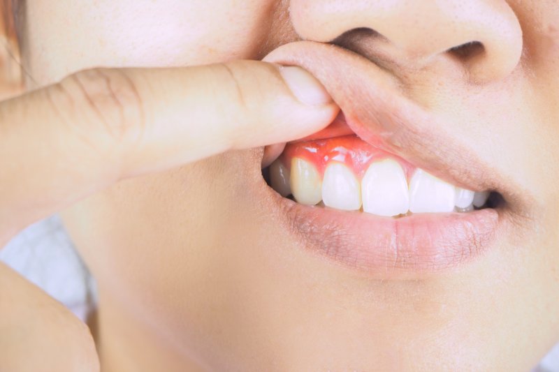 Woman with inflamed gums