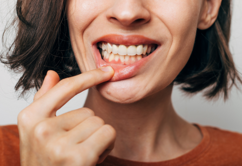 Woman showing gums